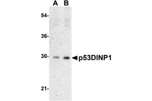 Western Blotting (WB) image for anti-Tumor Protein P53 Inducible Nuclear Protein 1 (TP53INP1) (N-Term) antibody (ABIN1031500) (TP53INP1 Antikörper  (N-Term))
