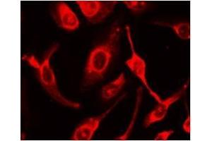 Immunocytochemical staining of HeLa Cells (FAS Antikörper  (N-Term))