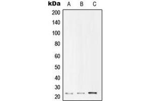 Western blot analysis of UBE2T expression in Jurkat (A), HepG2 (B), HeLa (C) whole cell lysates. (Ube2t Antikörper  (Center))