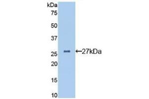 Detection of Recombinant CLU, Mouse using Polyclonal Antibody to Clusterin (CLU) (Clusterin Antikörper  (AA 227-448))