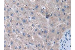 DAB staining on IHC-P; Samples: Human Liver Tissue (MMP15 Antikörper  (AA 280-497))