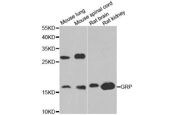 Gastrin-Releasing Peptide Antikörper  (AA 1-148)