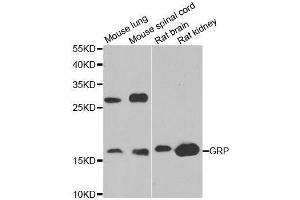 Western blot analysis of extracts of various cell lines, using GRP antibody. (Gastrin-Releasing Peptide Antikörper  (AA 1-148))
