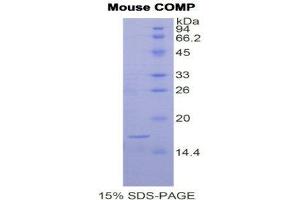 SDS-PAGE (SDS) image for Cartilage Oligomeric Matrix Protein (COMP) (AA 40-180) protein (His tag) (ABIN1878396)