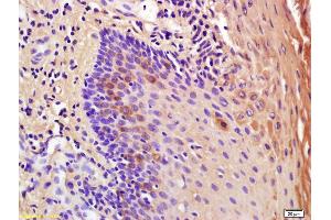 Immunohistochemistry (IHC) image for anti-Interleukin 1 Receptor Antagonist (IL1RN) (AA 26-120) antibody (ABIN678743)