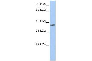 TMCC1 antibody used at 1 ug/ml to detect target protein. (TMCC1 Antikörper  (C-Term))
