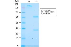 SDS-PAGE Analysis Purified ACTH Recombinant Mouse Monoclonal Antibody (rCLIP/1418). (Rekombinanter POMC Antikörper  (AA 25-39))