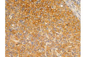 ABIN6256968 and ABIN6274914 at 1/100 staining Rat ovarian tissue by IHC-P. (Glucuronidase beta Antikörper  (Internal Region))