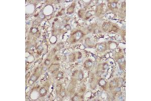 Immunohistochemistry of paraffin-embedded human liver using NDUFB8 Rabbit pAb (ABIN7268814) at dilution of 1:100 (40x lens). (NDUFB8 Antikörper)