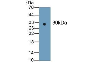 Detection of Recombinant IDH1, Human using Monoclonal Antibody to Isocitrate Dehydrogenase 1, Soluble (IDH1) (IDH1 Antikörper  (AA 74-333))