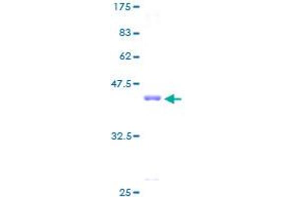 RPS16 Protein (AA 1-146) (GST tag)