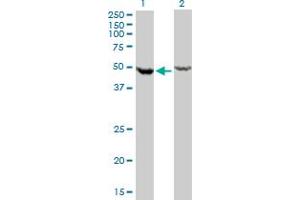 Western Blotting (WB) image for anti-DEAD (Asp-Glu-Ala-Asp) Box Polypeptide 6 (DDX6) (AA 1-484) antibody (ABIN598641) (DDX6 Antikörper  (AA 1-484))
