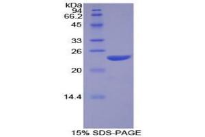 SDS-PAGE analysis of Human NOS1 Protein. (NOS1 Protein)