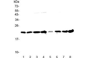 Western blot testing of human 1) HeLa, 2) placenta, 3) MCF7, 4) COLO320, 5) 22RV1, 6) HepG2, 7) A431 and 8) U937 lysate with GLO1 antibody at 0. (GLO1 Antikörper)