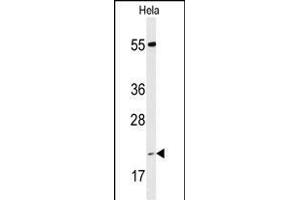 Western blot analysis of IC Antibody (Center) (ABIN653304 and ABIN2842804) in Hela cell line lysates (35 μg/lane). (PPIC Antikörper  (AA 61-89))