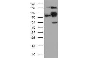 Western Blotting (WB) image for anti-Folate Hydrolase (Prostate-Specific Membrane Antigen) 1 (FOLH1) antibody (ABIN1500455) (PSMA Antikörper)