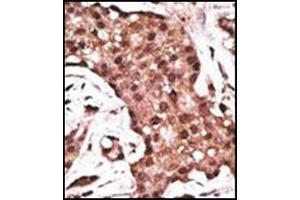 Immunohistochemistry (Paraffin-embedded Sections) (IHC (p)) image for anti-ATG5 Autophagy Related 5 (ATG5) (AA 1-30), (N-Term) antibody (ABIN1449605)