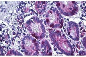 Human Small Intestine: Formalin-Fixed, Paraffin-Embedded (FFPE) (KIFC1 Antikörper  (AA 53-152))