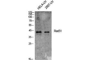 Western Blot (WB) analysis of specific cells using Rad51 Polyclonal Antibody. (RAD51 Antikörper  (Thr555))