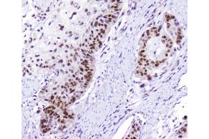 IHC analysis of AHR using anti-AHR antibody (ABIN6719265). (Aryl Hydrocarbon Receptor Antikörper)