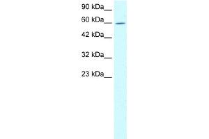 WB Suggested Anti-TRIM15 Antibody Titration:  1. (TRIM15 Antikörper  (N-Term))