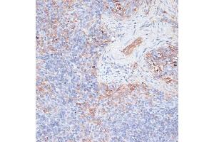 Immunohistochemistry of paraffin-embedded mouse spleen using Cathepsin G antibody (ABIN6127686, ABIN6139228, ABIN6139230 and ABIN6217069) at dilution of 1:100 (40x lens). (Cathepsin G Antikörper  (AA 75-190))