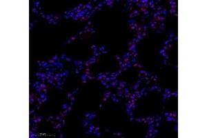Immunofluorescence of paraffin embedded rat lung using tfiib (ABIN7074034) at dilution of 1: 500 (300x lens) (GTF2B Antikörper)