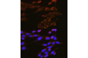 Immunofluorescence analysis of NIH-3T3 cells using DNM2 Rabbit pAb (ABIN6127773, ABIN6139741, ABIN6139742 and ABIN6223876) at dilution of 1:100 (40x lens). (DNM2 Antikörper  (AA 607-866))