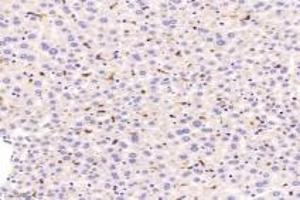 Immunohistochemistry of paraffin embedded mouse liver using F480 (ABIN7073801) at dilution of 1:1200 (200x lens)