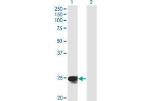 Western Blot analysis of YKT6 expression in transfected 293T cell line by YKT6 monoclonal antibody (M03), clone 1F8. (YKT6 Antikörper  (AA 99-198))