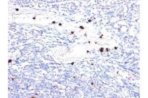 Image no. 1 for anti-Colony Stimulating Factor 3 (Granulocyte) (CSF3) antibody (ABIN6161622) (G-CSF Antikörper)
