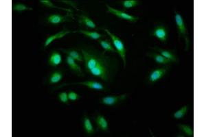 Immunofluorescence staining of Hela cells with ABIN7142198 at 1:200, counter-stained with DAPI. (PSMD1 Antikörper  (Regulatory Subunit 10))