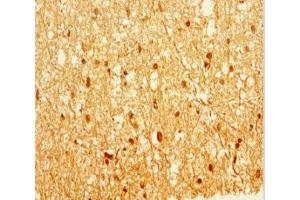 Immunohistochemistry of paraffin-embedded human brain tissue using ABIN7157846 at dilution of 1:100 (EPM2A Antikörper  (Isoform 9))