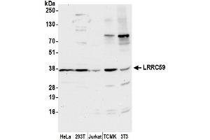 anti-Leucine Rich Repeat Containing 59 (LRRC59) (AA 200-250) antibody