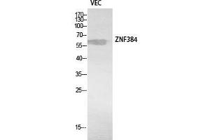 Western Blot (WB) analysis of VEC cells using ZNF384 Polyclonal Antibody. (ZNF384 Antikörper  (Internal Region))