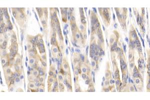 Detection of MCP1 in Mouse Stomach Tissue using Polyclonal Antibody to Monocyte Chemotactic Protein 1 (MCP1) (CCL2 Antikörper  (AA 24-96))