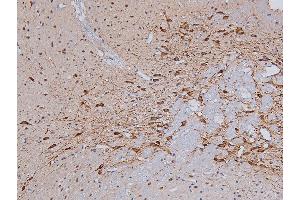 ABIN6267325 at 1/200 staining Rat brain tissue sections by IHC-P. (Tyrosine Hydroxylase Antikörper  (pSer31))