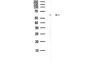 anti-CAMP Responsive Element Binding Protein 3-Like 2 (CREB3L2) (Internal Region) antibody