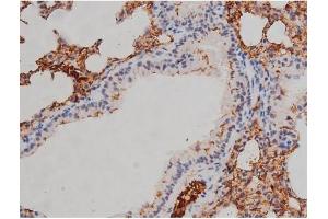 Immunohistochemistry (IHC) image for anti-V-Yes-1 Yamaguchi Sarcoma Viral Related Oncogene Homolog (LYN) (pTyr507) antibody (ABIN6256754)