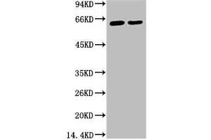 Western blot analysis of 1) Hela, 2) HepG2, diluted at 1:2000. (KRT6A Antikörper)