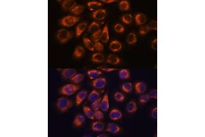Immunofluorescence (IF) image for anti-Stromal Membrane Associated Protein 1 (SMAP1) (AA 180-250) antibody (ABIN7270612)