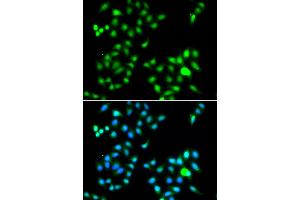 Immunofluorescence analysis of A549 cells using TWIST1 antibody (ABIN4905524). (TWIST1 Antikörper)