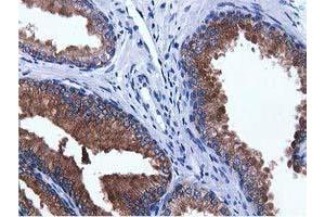 Immunohistochemical staining of paraffin-embedded Human prostate tissue using anti-ADI1 mouse monoclonal antibody.