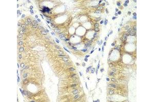 Immunohistochemistry of paraffin-embedded Human colon using CES2 Polyclonal Antibody at dilution of 1:100 (40x lens). (CES2 Antikörper)