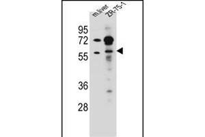 TRIM62 Antibody (C-term) (ABIN657216 and ABIN2837911) western blot analysis in mouse liver tissue and ZR-75-1 cell line lysates (35 μg/lane). (TRIM62 Antikörper  (C-Term))