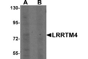 Western Blotting (WB) image for anti-Leucine Rich Repeat Transmembrane Neuronal 4 (LRRTM4) (Middle Region) antibody (ABIN1030989)