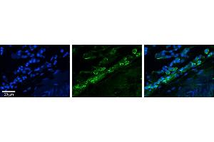 Immunohistochemistry (IHC) image for anti-Gap Junction Protein, alpha 4, 37kDa (GJA4) (Middle Region) antibody (ABIN2774856)