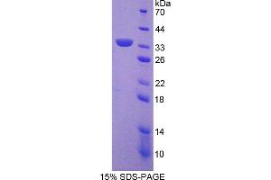 Image no. 1 for Sirtuin 5 (SIRT5) (AA 37-310) protein (His tag) (ABIN6237076) (SIRT5 Protein (AA 37-310) (His tag))