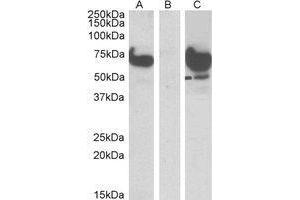 HEK293 lysate (10ug protein in RIPA buffer) overexpressing Human EPM2AIP1 with DYKDDDDK tag probed with AP23768PU-N (1µg/ml) in Lane A and probed with anti-DYKDDDDK Tag (1/1000) in lane C.