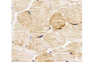 Immunohistochemistry analysis of paraffin-embedded mouse skeletal muscle using PPAPDC3 (ABIN7075036) at dilution of 1: 4000 (PPAPDC3 Antikörper)